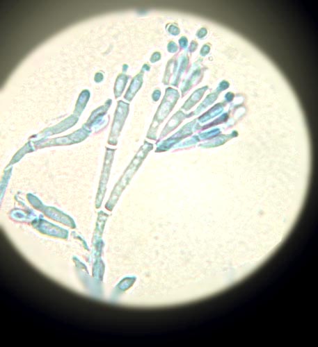 Cordées de la Réussite, avec l’IUT Génie Biologique de Laval.